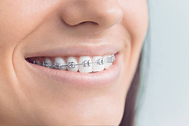 Best Veneers and Lumineers  in Houston, TX